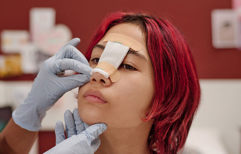 ¿La rinoplastia duele? Desmintiendo mitos de la recuperación